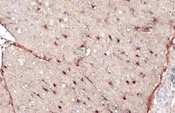 Anti-S100 beta antibody used in IHC (Paraffin sections) (IHC-P). GTX129573