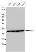 Anti-RNPS1 antibody used in Western Blot (WB). GTX129789