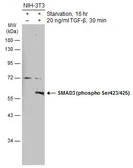 Anti-SMAD3 (phospho Ser423/425) antibody used in Western Blot (WB). GTX129841