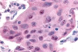 Anti-ERR alpha antibody used in IHC (Paraffin sections) (IHC-P). GTX12985