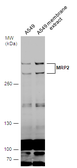 Anti-MRP2 antibody used in Western Blot (WB). GTX130181