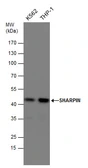 Anti-SHARPIN antibody used in Western Blot (WB). GTX130231
