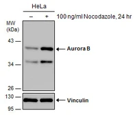 Anti-Aurora B antibody used in Western Blot (WB). GTX130238