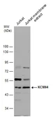 Anti-KCNN4 antibody used in Western Blot (WB). GTX130239
