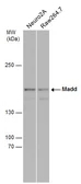 Anti-MADD antibody used in Western Blot (WB). GTX130249