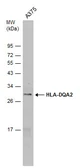 Anti-HLA-DQA2 antibody used in Western Blot (WB). GTX130259