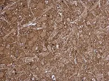Anti-LKB1 antibody used in IHC (Paraffin sections) (IHC-P). GTX130697