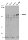 Anti-ARID1B antibody used in Western Blot (WB). GTX130708