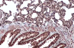 Anti-CDK12 antibody used in IHC (Paraffin sections) (IHC-P). GTX130809