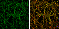 Anti-Nectin 1 antibody used in Immunocytochemistry/ Immunofluorescence (ICC/IF). GTX130824