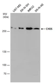 Anti-CHD5 antibody used in Western Blot (WB). GTX131065