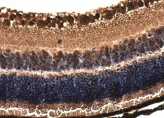 Anti-Phosducin / PDC antibody used in IHC (Paraffin sections) (IHC-P). GTX131327
