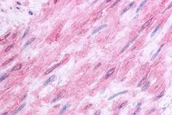 Anti-5-HT1B receptor antibody used in IHC (Paraffin sections) (IHC-P). GTX13154