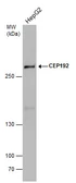 Anti-CEP192 antibody used in Western Blot (WB). GTX131891
