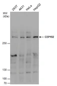 Anti-CEP192 antibody used in Western Blot (WB). GTX131892