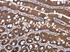 Anti-Raptor antibody used in IHC (Paraffin sections) (IHC-P). GTX132303