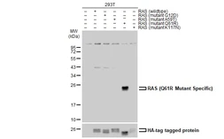 Anti-RAS (Q61R Mutant) antibody used in Western Blot (WB). GTX132405