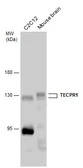 Anti-TECPR1 antibody used in Western Blot (WB). GTX132572