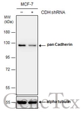 Anti-pan Cadherin antibody used in Western Blot (WB). GTX132646