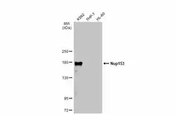 Anti-Nup153 antibody used in Western Blot (WB). GTX132731