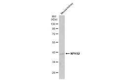 Anti-NPHS2 antibody used in Western Blot (WB). GTX132753