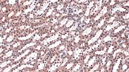 Anti-hnRNP L antibody used in IHC (Paraffin sections) (IHC-P). GTX132760