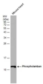 Anti-Phospholamban antibody used in Western Blot (WB). GTX132854