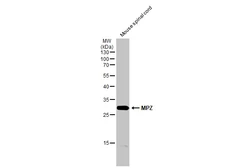Anti-MPZ antibody used in Western Blot (WB). GTX132954