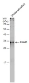 Anti-Ccnd1 antibody used in Western Blot (WB). GTX133053