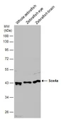 Anti-Sox4a antibody used in Western Blot (WB). GTX133062