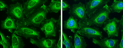 Anti-IP3 Receptor I antibody used in Immunocytochemistry/ Immunofluorescence (ICC/IF). GTX133104