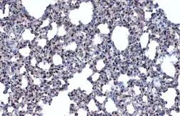 Anti-NKX2.1 antibody used in IHC (Paraffin sections) (IHC-P). GTX133121
