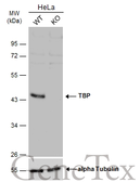 Anti-TBP antibody used in Western Blot (WB). GTX133204