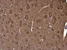 Anti-NSE antibody used in IHC (Paraffin sections) (IHC-P). GTX133249