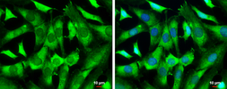 Anti-WAVE1 antibody used in Immunocytochemistry/ Immunofluorescence (ICC/IF). GTX133263