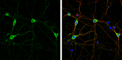 Anti-DLGAP1 antibody used in Immunocytochemistry/ Immunofluorescence (ICC/IF). GTX133264