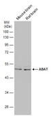 Anti-ABAT antibody used in Western Blot (WB). GTX133340