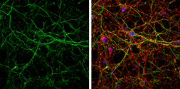 Anti-alpha Internexin antibody used in Immunocytochemistry/ Immunofluorescence (ICC/IF). GTX133356