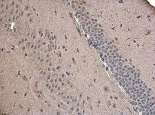 Anti-ABAT antibody used in IHC (Paraffin sections) (IHC-P). GTX133362