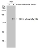 Anti-PLCG2 (phospho Tyr759) antibody used in Western Blot (WB). GTX133463