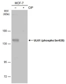 Anti-ULK1 (phospho Ser638) antibody used in Western Blot (WB). GTX133540