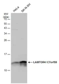 Anti-LAMTOR4 antibody used in Western Blot (WB). GTX133564