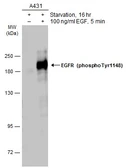 Anti-EGFR (phospho Tyr1148) antibody used in Western Blot (WB). GTX133594