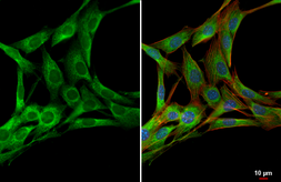Anti-PDGF Receptor alpha antibody used in Immunocytochemistry/ Immunofluorescence (ICC/IF). GTX133620