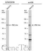 Anti-PKC mu antibody used in Western Blot (WB). GTX133778