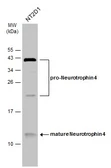 Anti-Neurotrophin 4 antibody used in Western Blot (WB). GTX133792