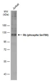 Anti-Rb (phospho Ser780) antibody used in Western Blot (WB). GTX133893