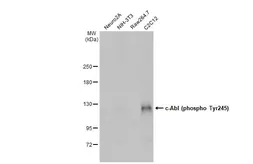 Anti-c-Abl (phospho Tyr245) antibody used in Western Blot (WB). GTX133980