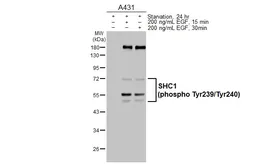 Anti-SHC1 (phospho Tyr239/240) antibody used in Western Blot (WB). GTX133985