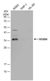 Anti-HOXB4 antibody used in Western Blot (WB). GTX134055